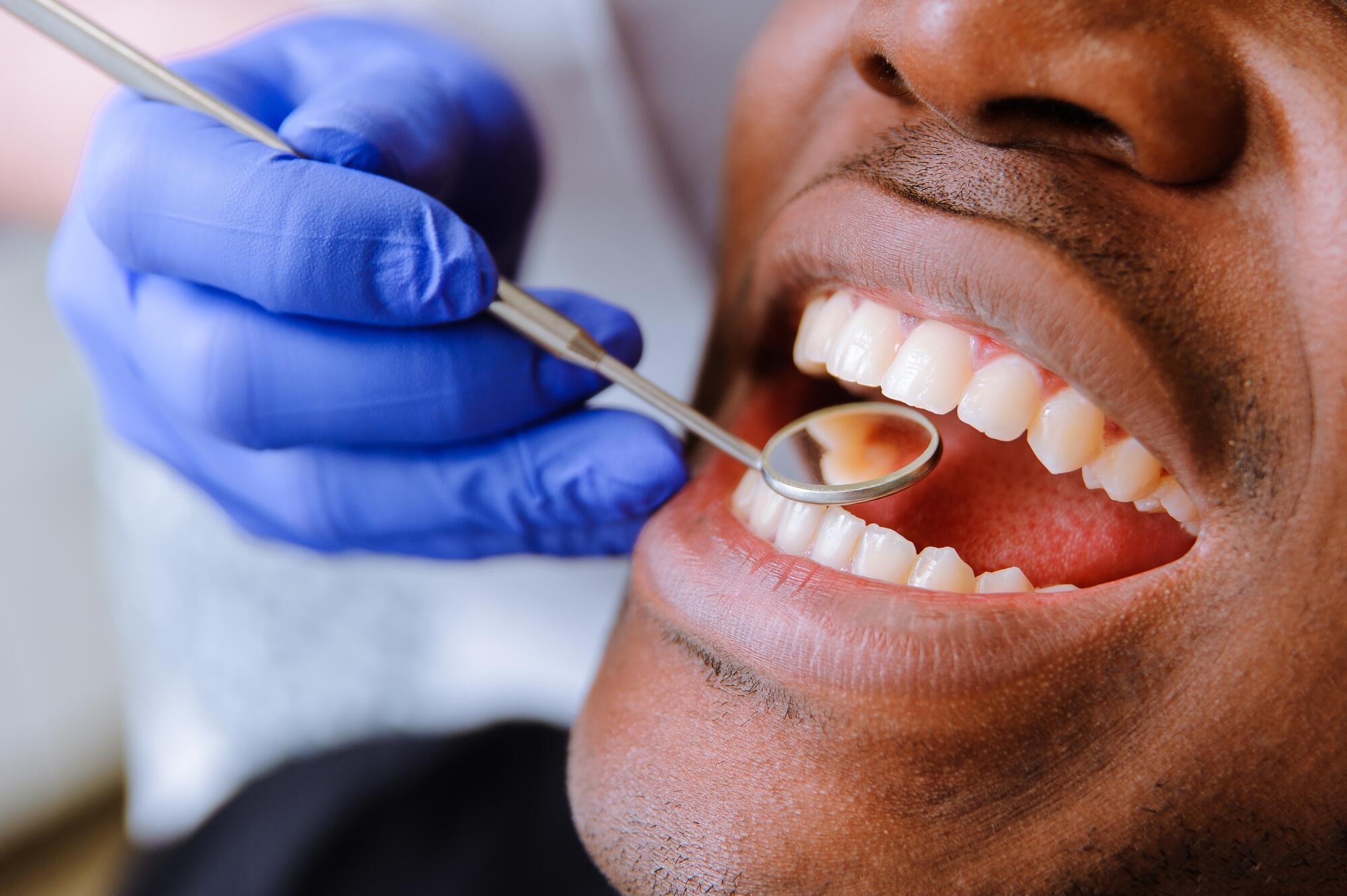 Dents d’homme qui fume